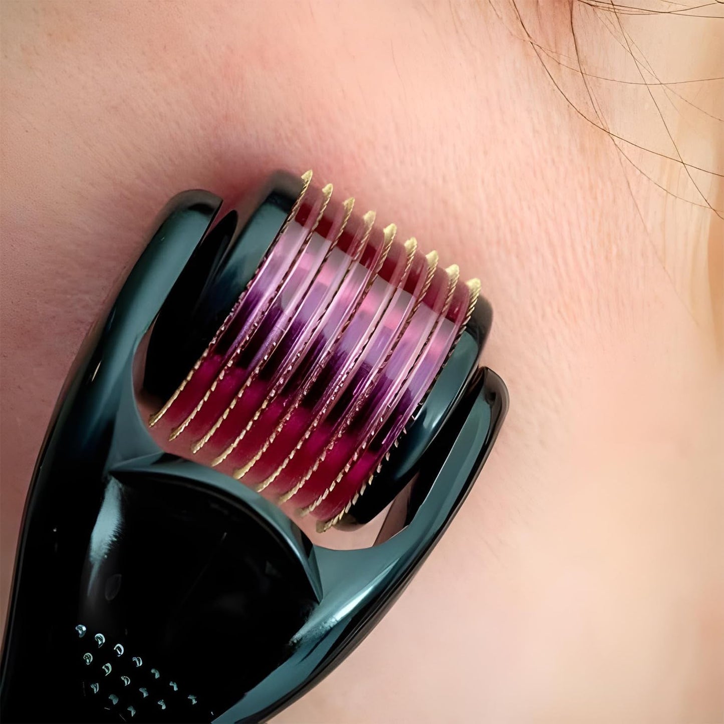 Derma Roller System